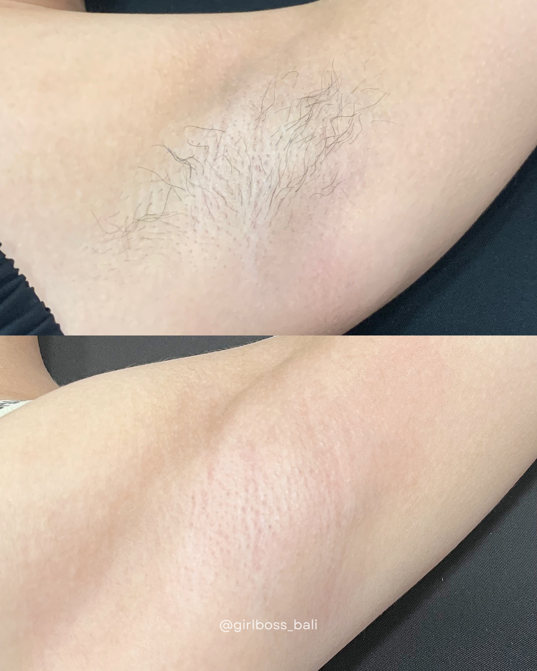 Home Service Waxing
